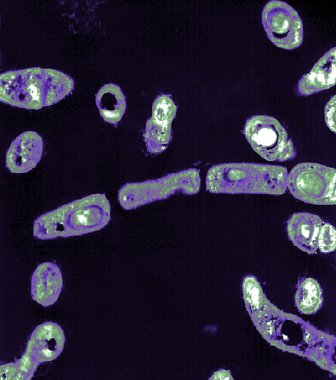 Bacillus anthracis