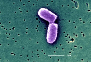 Escherichia coli bakteri