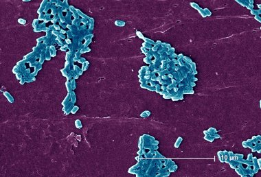 Escherichia coli bakteri