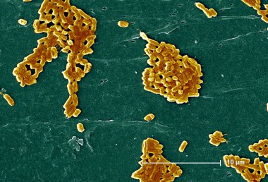 Escherichia coli bakteri