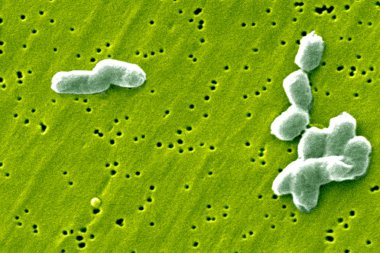 Salmonella infantis bakteriler