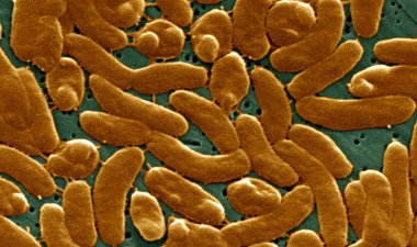 Vibrio vulnificus bakteri