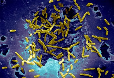 Mycobacterium chelonae clipart