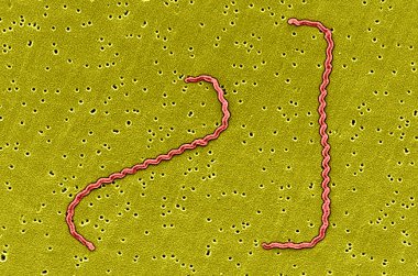 Leptospira interrogans