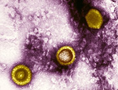 icosahedral şeklindeki herpesvirus virions