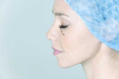 yüz plastik cerrahi