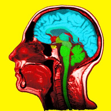 sagittal bölümü