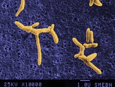 anaerobe bakteriler