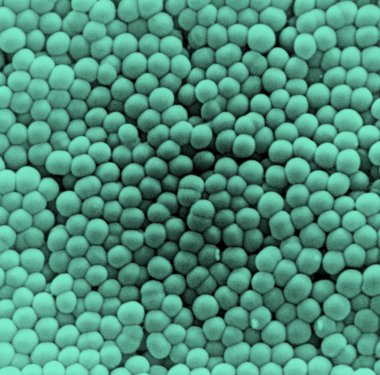 Ayagin Gram-negatif cocci