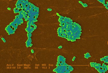 Escherichia Coli