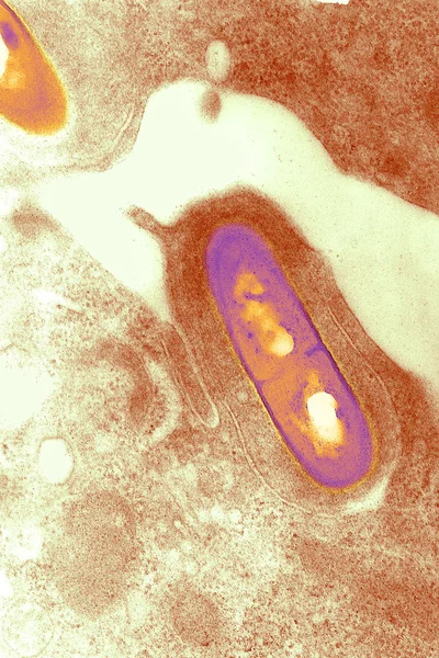 Listeria bacterium no tecido — Fotografia de Stock