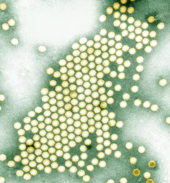 Virus della polio — Foto Stock