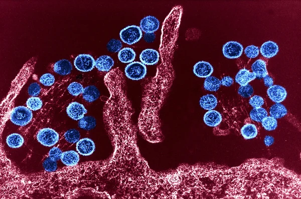 Sin Nombre hantavirus — Stok fotoğraf