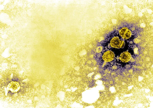 Hepatitis B — Foto de Stock
