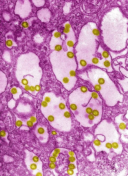 Virus della febbre della Rift Valley — Foto Stock