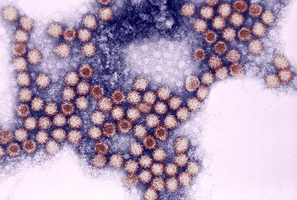 Kedigil calicivirus — Stok fotoğraf