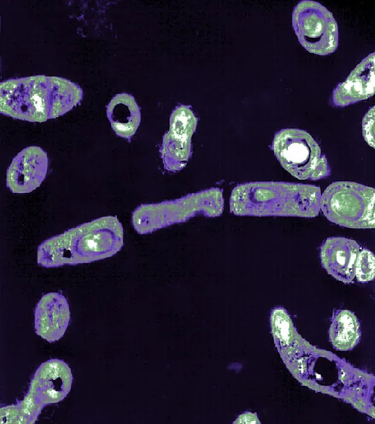 El Bacillus anthracis —  Fotos de Stock