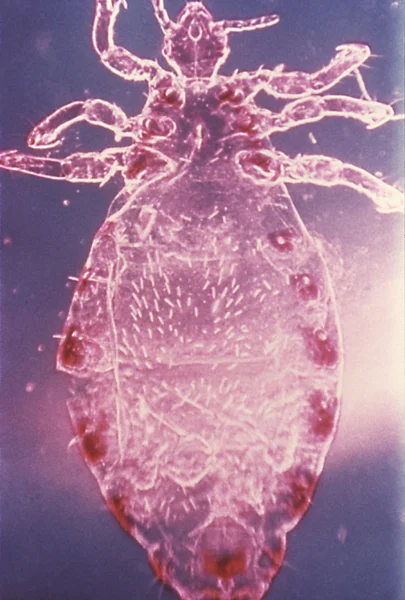 This is an enlarged view of a male head louse — Stock Photo, Image