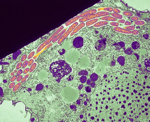 Tetrahymena pyriformis — Zdjęcie stockowe