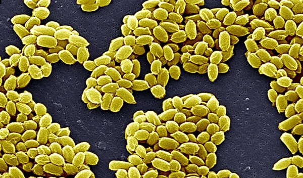 Bactéries Bacillus anthracis — Photo