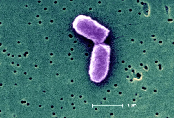 Bactérias Escherichia coli — Fotografia de Stock