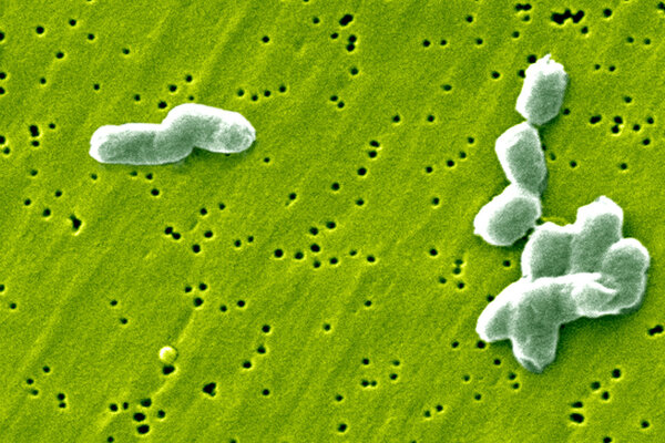 Бактерии Salmonella infantis
