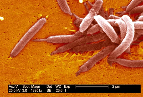 Flexispira rappini bakteriler — Stok fotoğraf