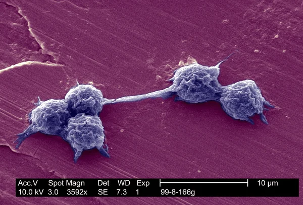 Hartmannella vermiformis kistler — Stok fotoğraf