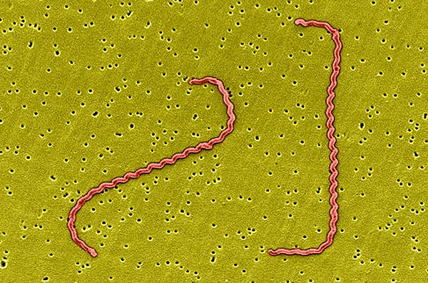 Leptospira interrogans —  Fotos de Stock