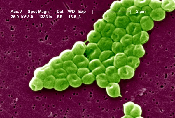 Acinetobacter baumannii bakterii — Zdjęcie stockowe