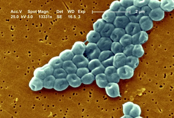 แบคทีเรีย Acinetobacter bauman — ภาพถ่ายสต็อก