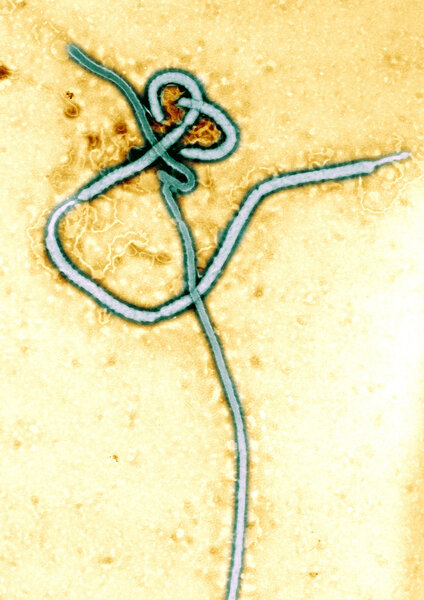 Микрограф вируса Эбола
