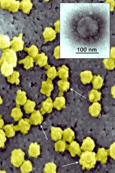 Partículas SARS-CoV — Foto de Stock