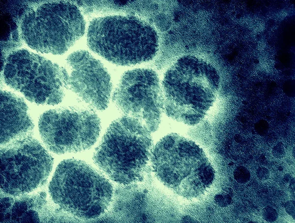 Smallpox virus — Stockfoto