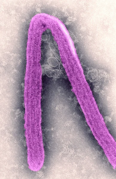 Marburg virus — Stock Photo, Image