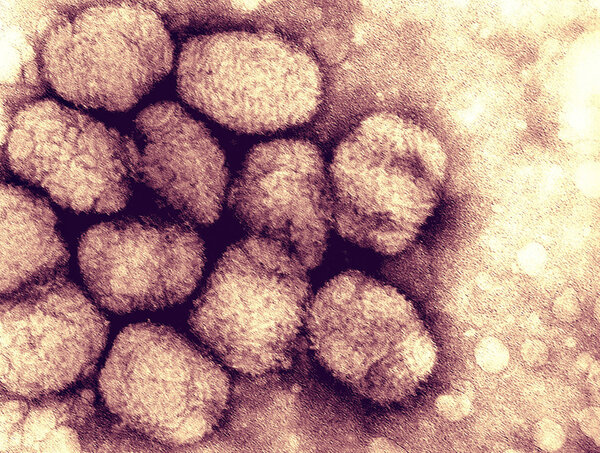 Smallpox viruses