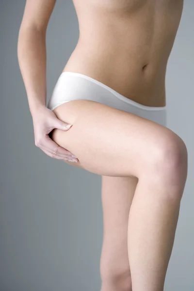 Cellulitis on leg — Stock Photo, Image