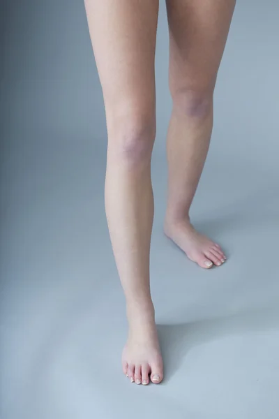 女腿 — 图库照片