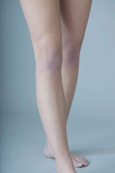 Pernas femininas — Fotografia de Stock
