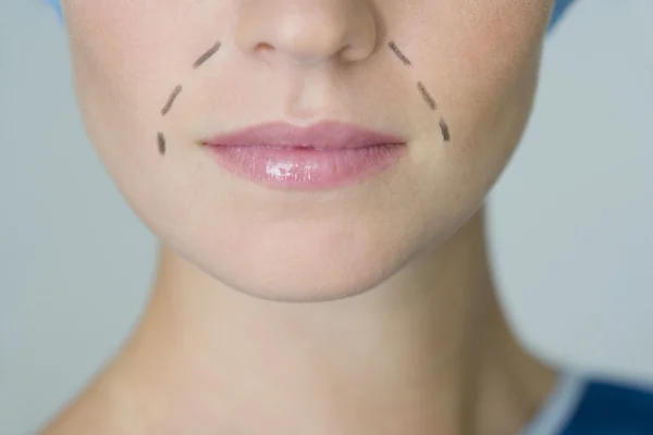 Cirugia plástica facial — Foto de Stock