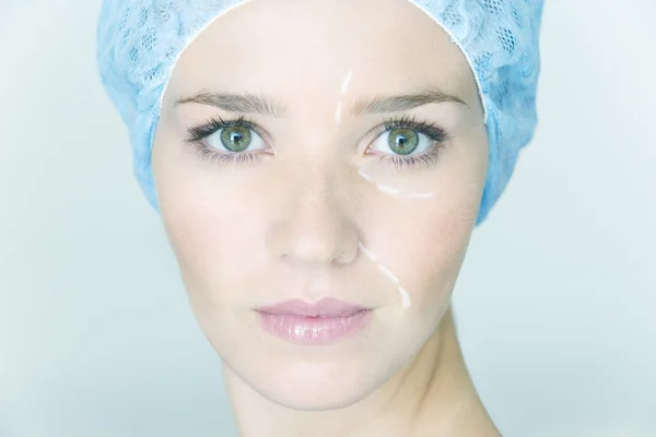 Plastische Chirurgie im Gesicht — Stockfoto