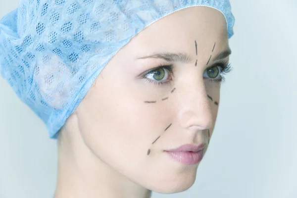 顔の整形手術 — ストック写真