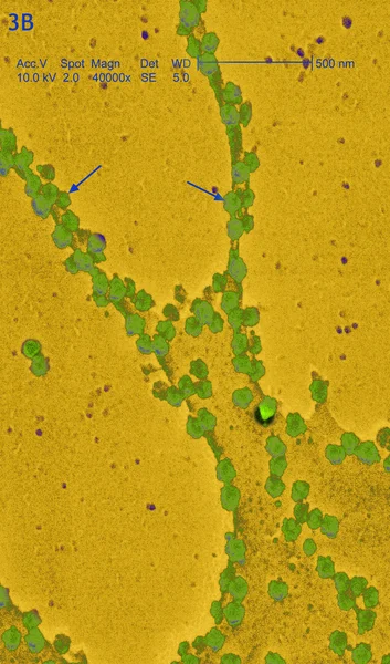 Coronavirus bajo microscopio —  Fotos de Stock