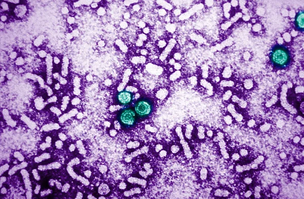 Virus dell'epatite — Foto Stock