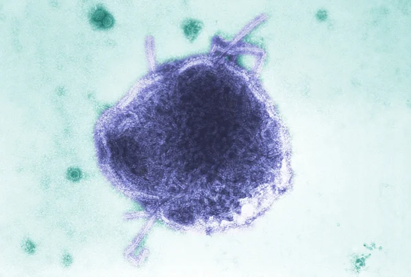 Virus del morbillo — Foto Stock