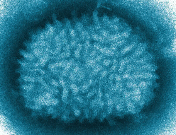 Virus under microscope