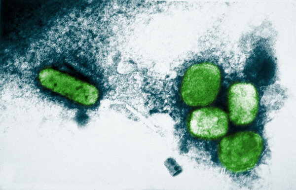 Virus under microscope