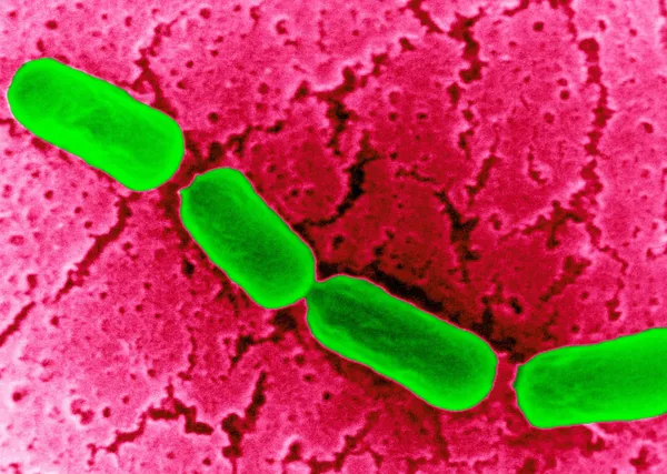 Anaerobe bacillus — Zdjęcie stockowe