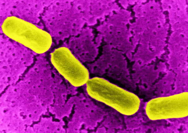 Anaerobe bacillus — Zdjęcie stockowe