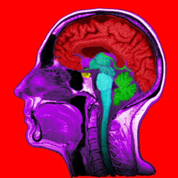 Sagittal bölümü — Stok fotoğraf